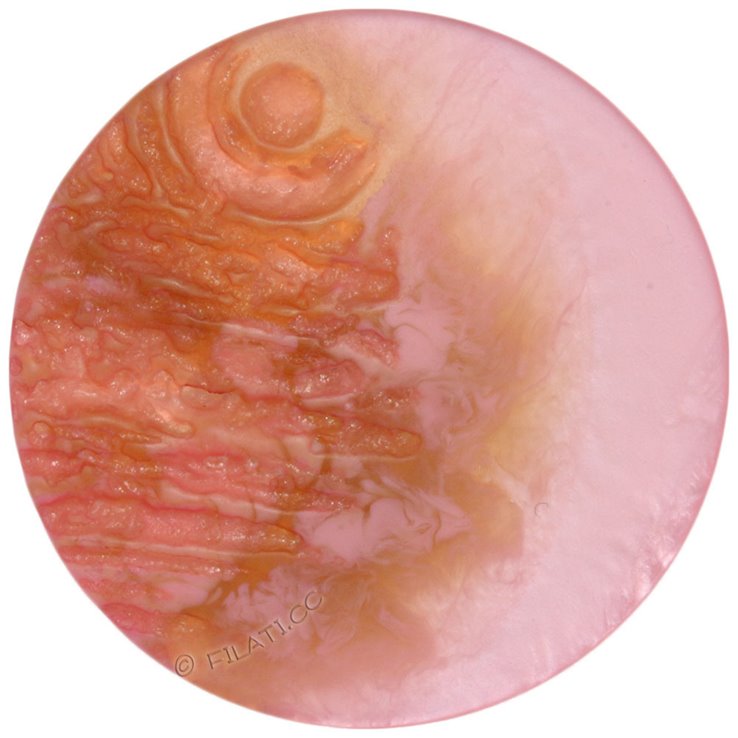 UNION KNOPF 452556/28mm | 46-rose